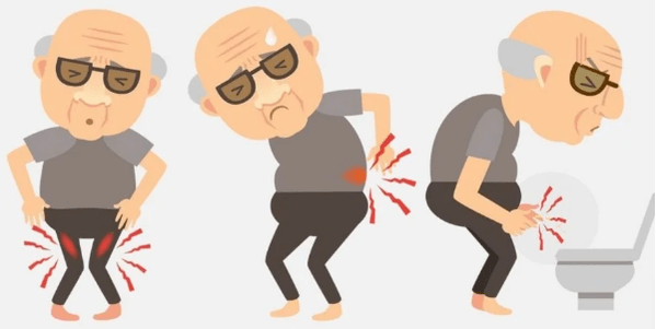 Prostatitis symptoms