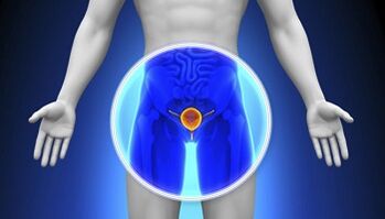 Treatment of drug prostatitis