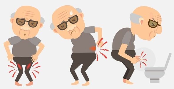 Symptoms of prostatitis and its treatment with medications.